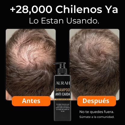 Shampoo para bloquear el DHT y activar el crecimiento capilar