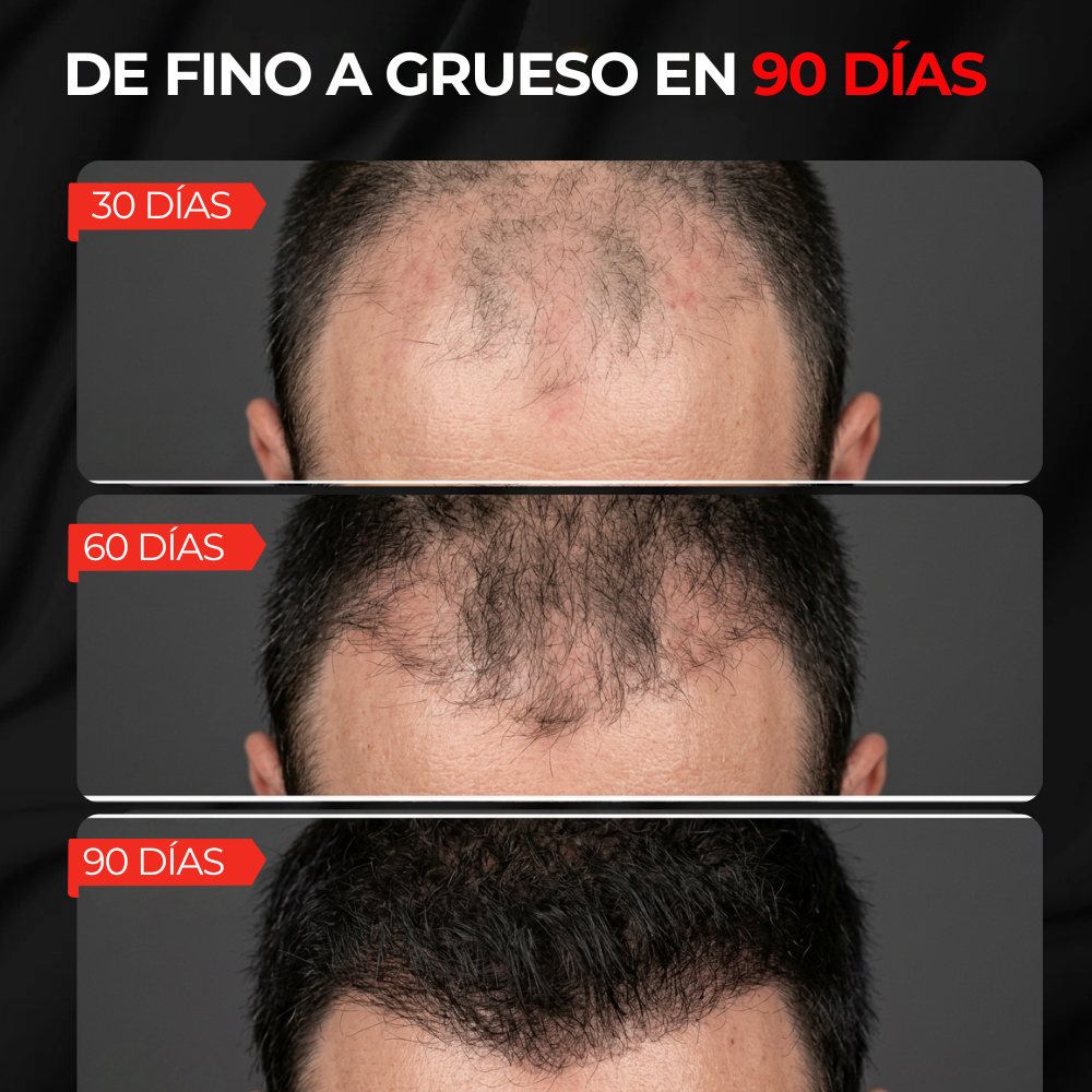 AuraHair | Gorro de Luz Roja para Recuperar tu Cabello