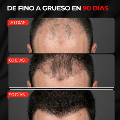 AuraHair | Gorro de Luz Roja para Recuperar tu Cabello